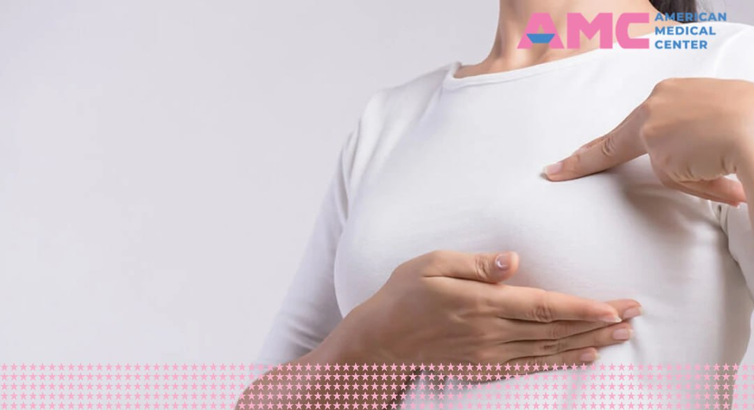 Check-up “Breast health”